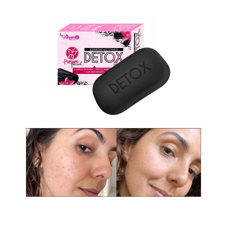 Jabón Carbón Activado Detox
